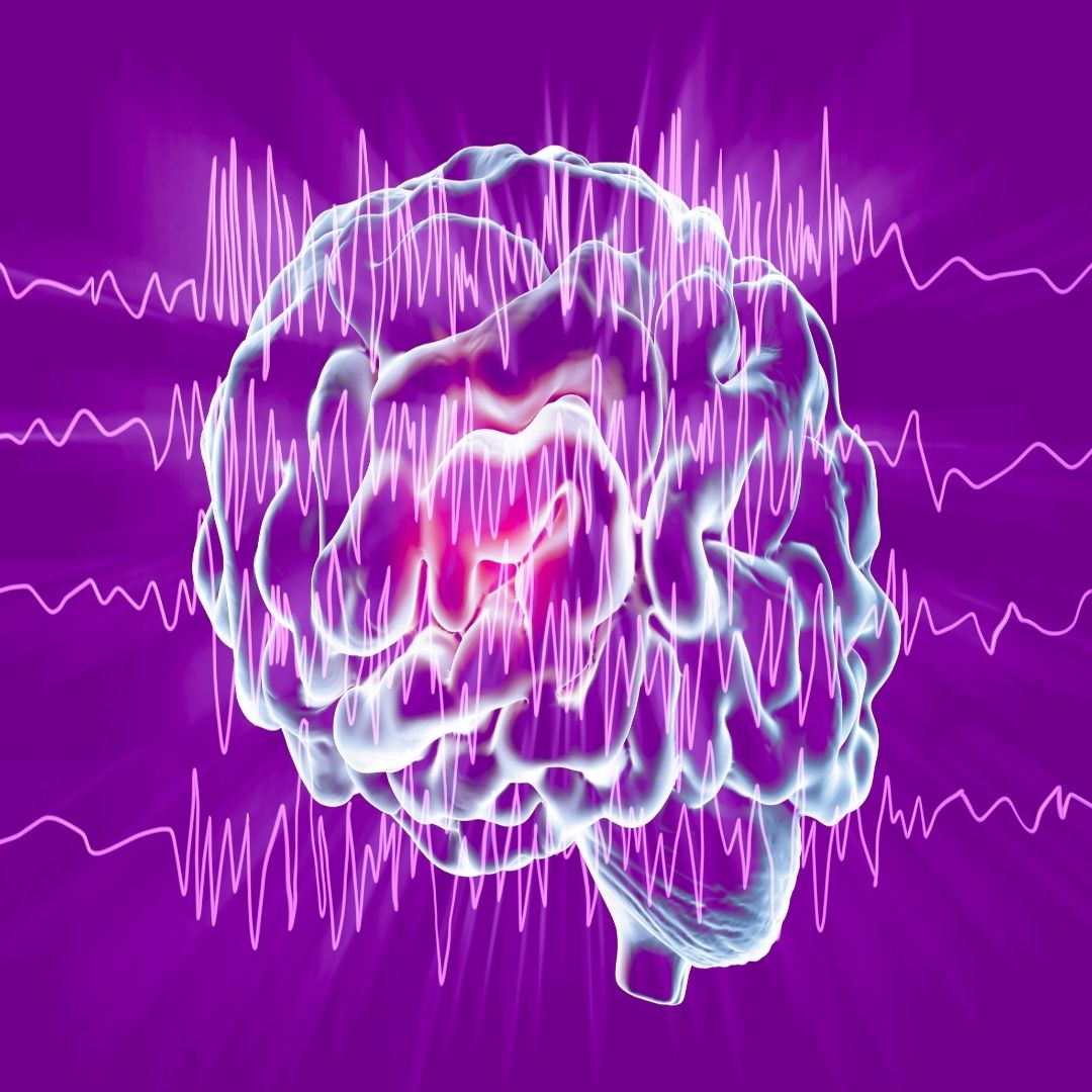 What is the Main Cause of Epilepsy Neurological Specialists CT