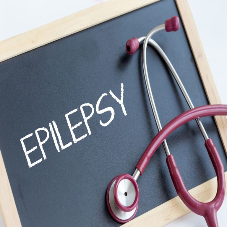 Things To Avoid If You Have Epilepsy - Neurological Specialists CT